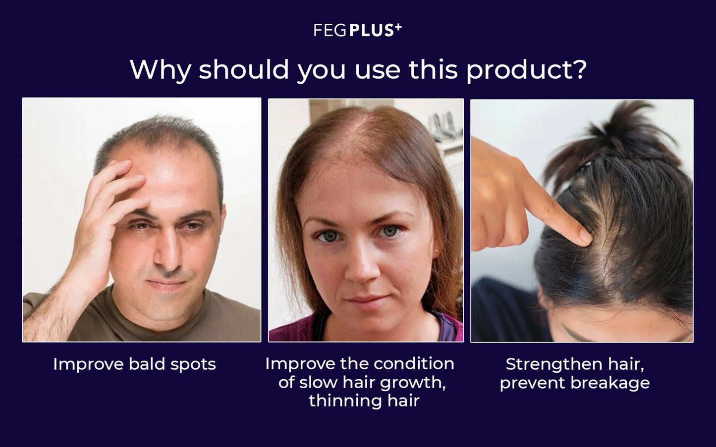 100% Original-FEG Plus Hair Fall Spray make hair long, thick, and strong lmprove Baldness/Balchar, prevent hair loss,